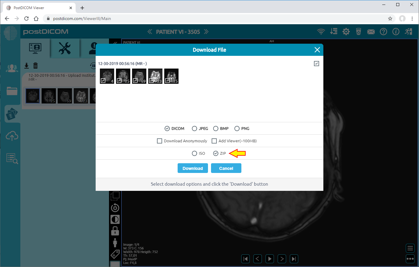 downloading patient images to disk