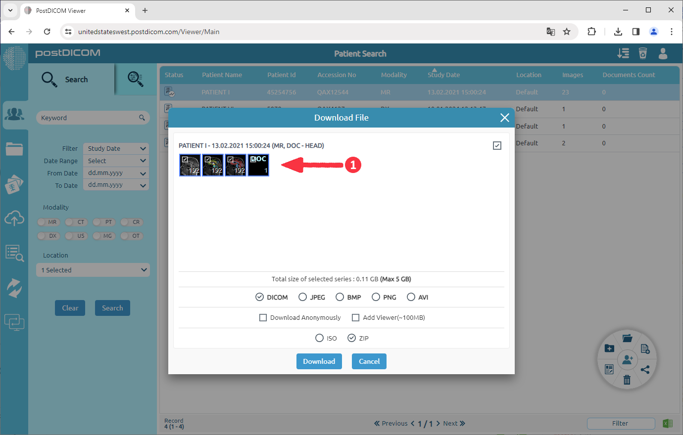 Downloading Patient Images to Disk