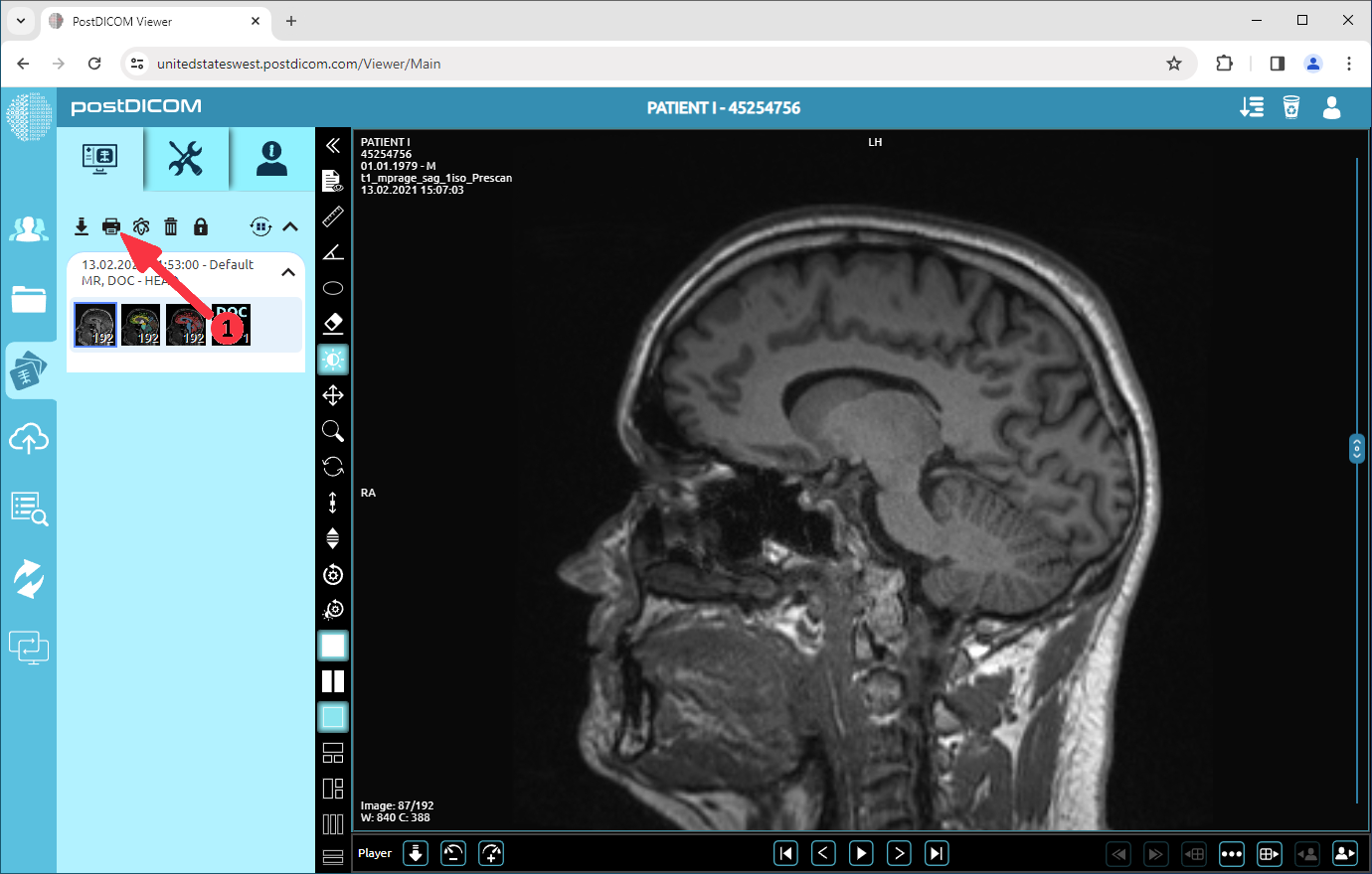 How to convert DICOM images to PDF