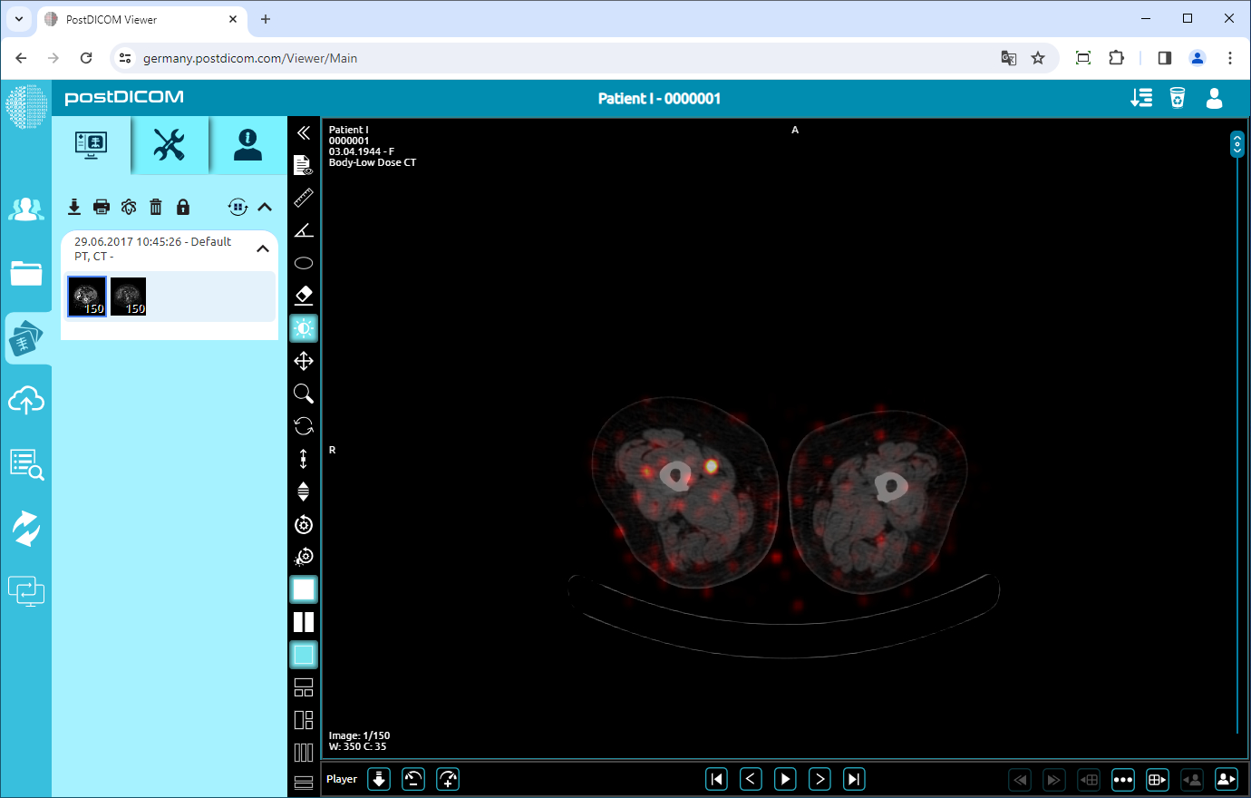 PET/CT, PET/MR Fusion