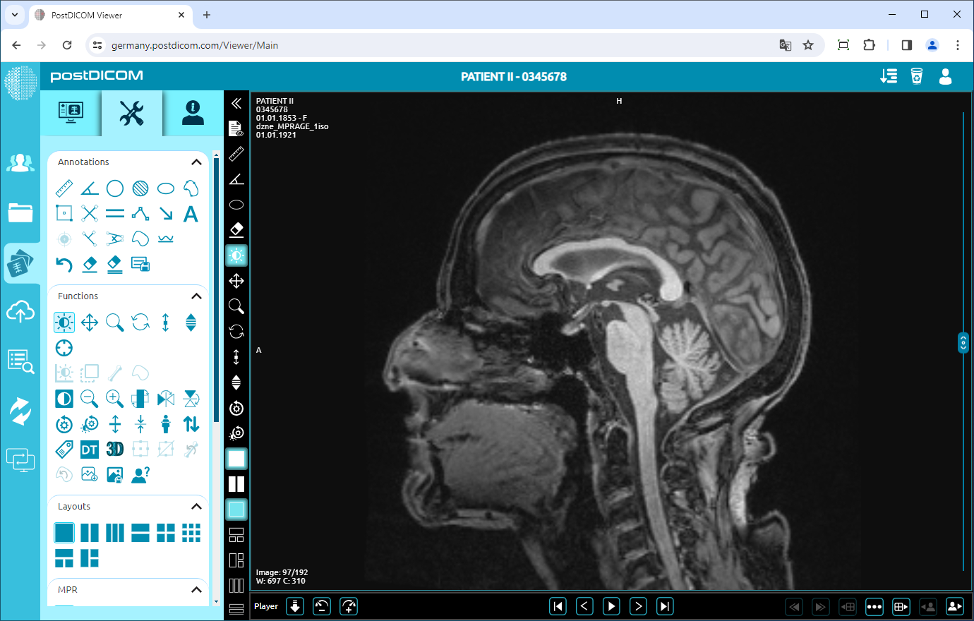 Showing/Hiding Patient Information on Viewport