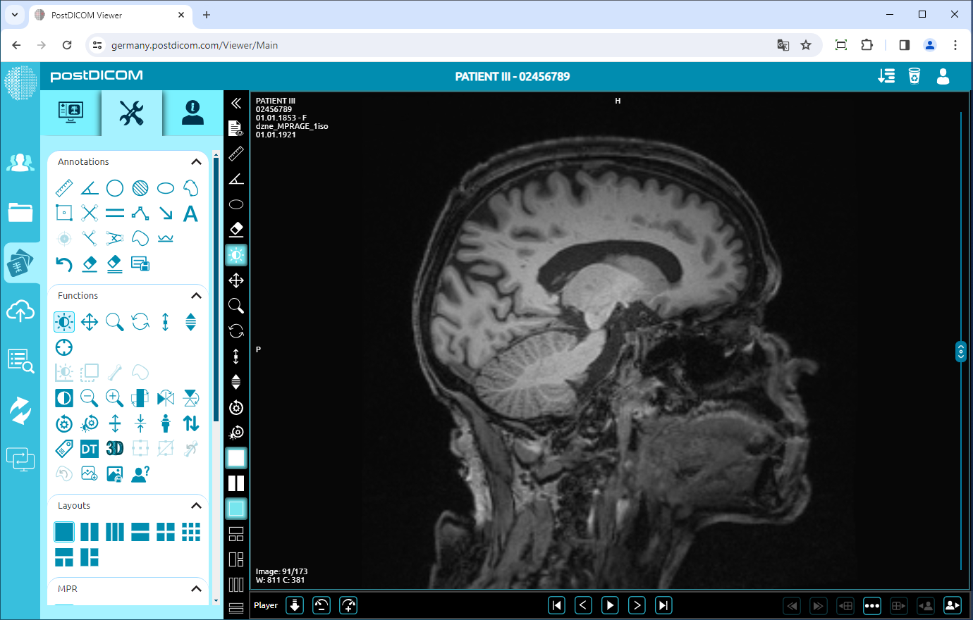 Using Negate, Rotate, Flip Vertical/Horizontal, Increase/Decrease Thickness, Zoom In/Out, Reset Functions