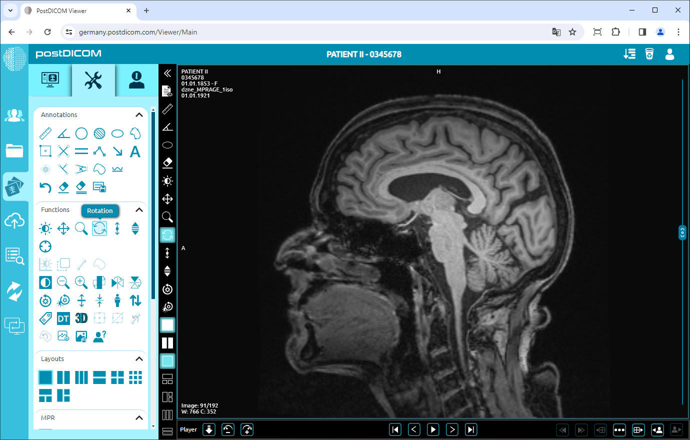 Using Window Level, Pan, Zoom, Rotation, Thickness and Scroll Functions