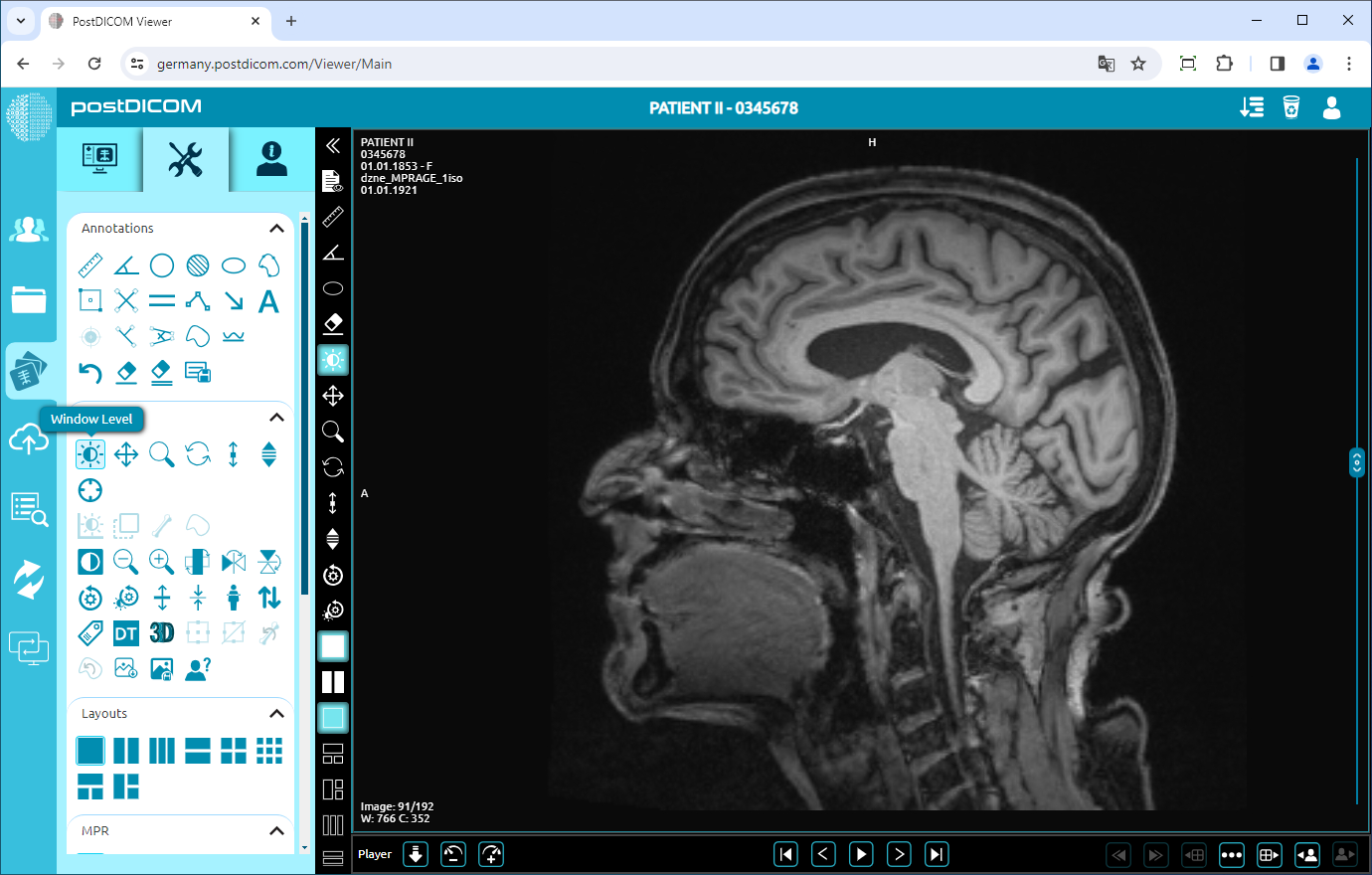 Using Window Level, Pan, Zoom, Rotation, Thickness and Scroll Functions