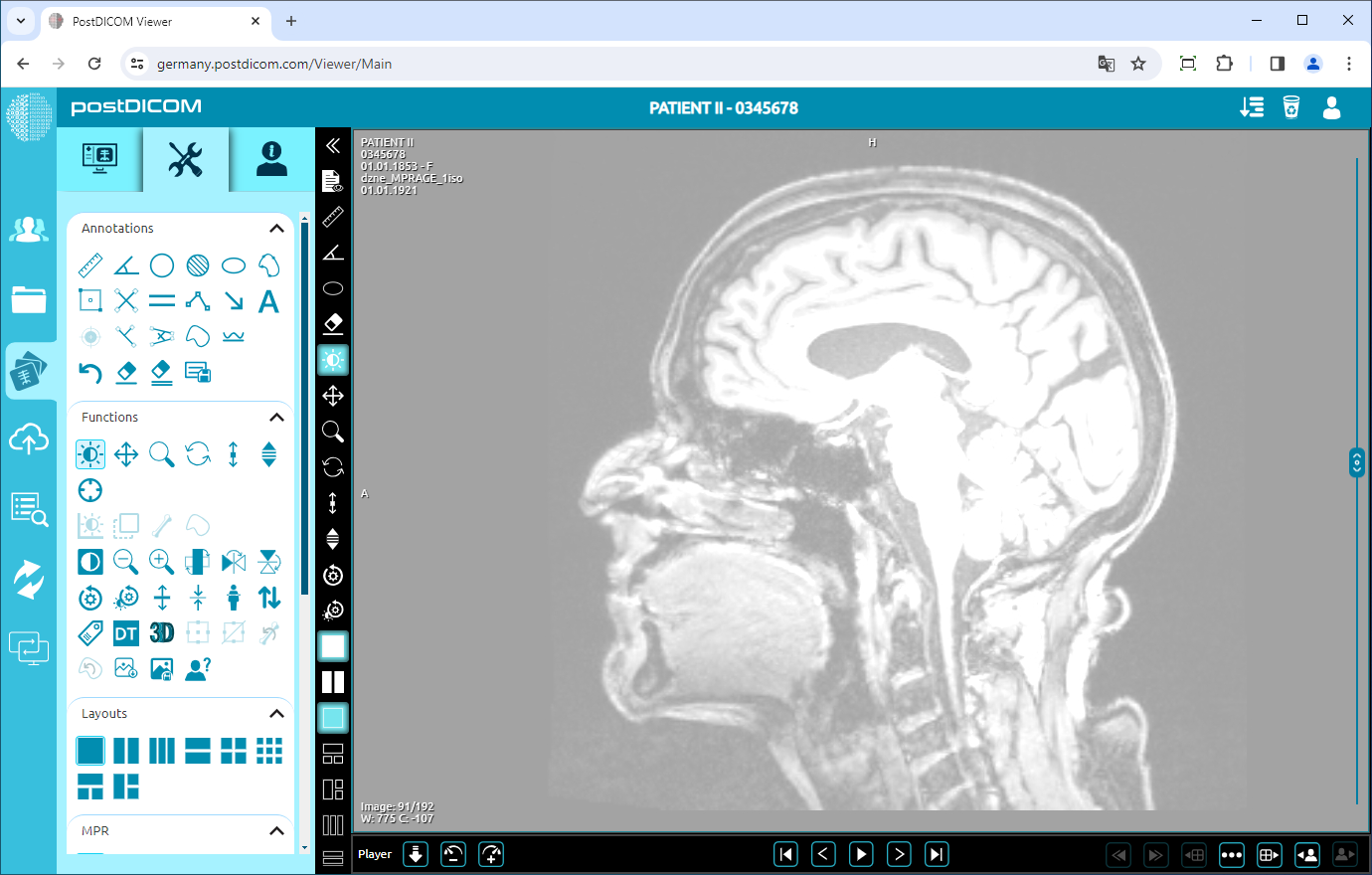 Using Window Level, Pan, Zoom, Rotation, Thickness and Scroll Functions