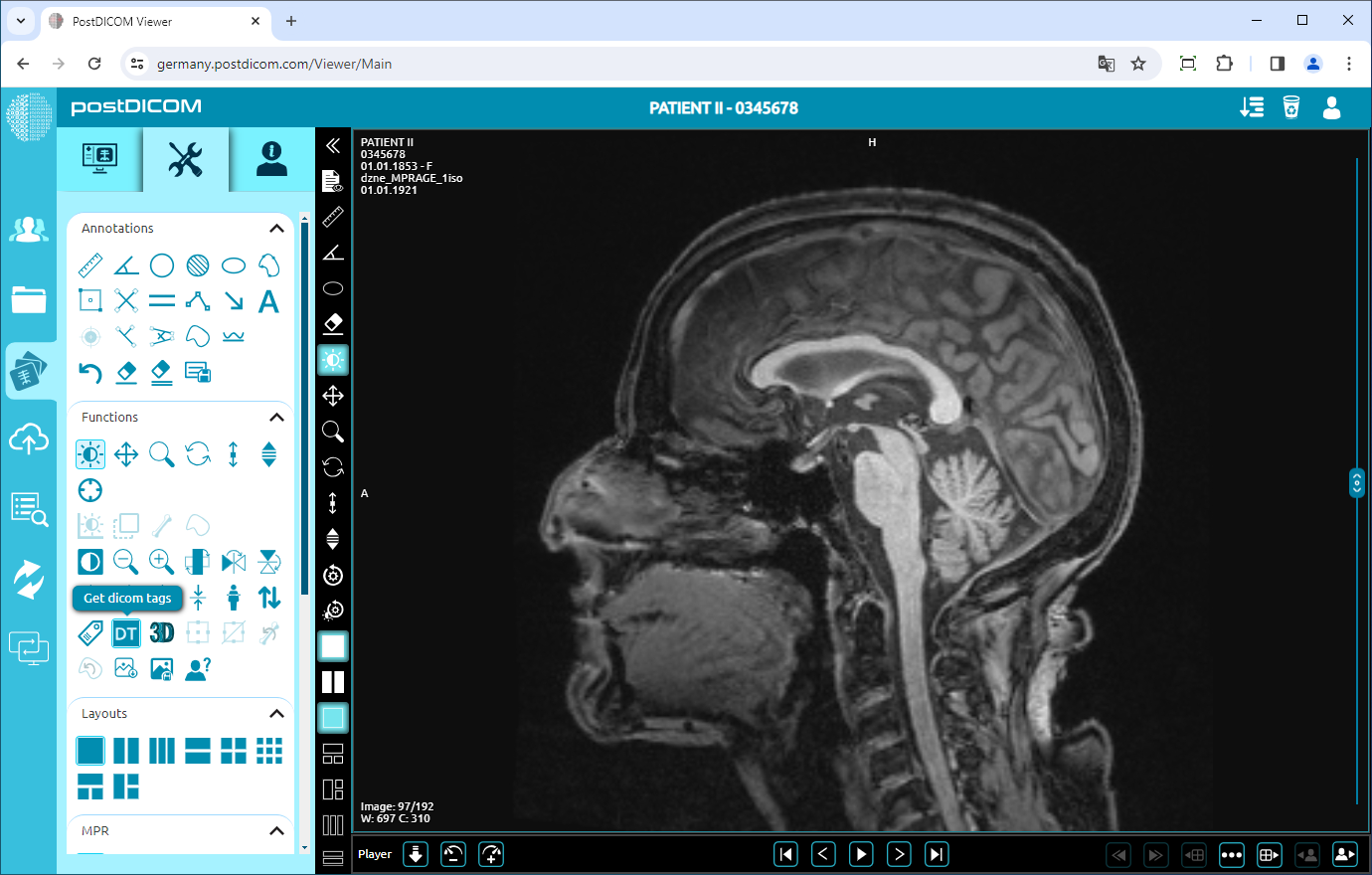 Viewing DICOM Tags